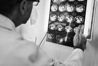 Omessa diagnosi di cancro e valutazione del nesso causale