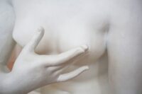 Prestazioni medico-estetiche ed esenzione IVA