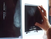 Il perimetro degli obblighi del medico radiologo