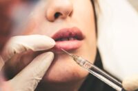 In vigore la legge inglese che vieta botox e filler sui minorenni