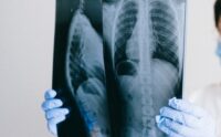 Il medico di famiglia? Non è corresponsabile delle scelte dei colleghi specialisti ospedalieri