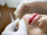 Odontoiatri e trattamenti estetici: le novità del “Decreto Bollette”