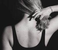 Omesso follow-up del melanoma: anche il chirurgo risponde del decesso del paziente