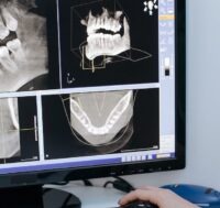 Condizioni e limiti dell’utilizzo della radiodiagnostica in odontoiatria