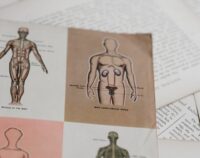 Rispetto delle prassi ospedaliere anziché delle linee guida: quale l’impatto sulla responsabilità?