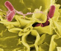 Infezioni nosocomiali: la Cassazione torna sull’onere della prova (parte I)