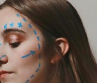 Foto del lifting “in chiaro” su Instagram: il Garante Privacy sanziona chirurgo estetico